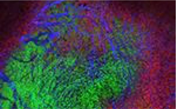 235437_web - Ralph Weissleder MD PhD - National Cancer Institute 235437_web - Ralph Weissleder MD PhD - National Cancer Institute