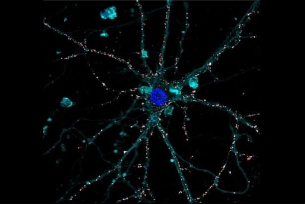 Artificial liquid retina - IIT-Istituto Italiano di Tecnologia - M Bramini Artificial liquid retina - IIT-Istituto Italiano di Tecnologia - M Bramini