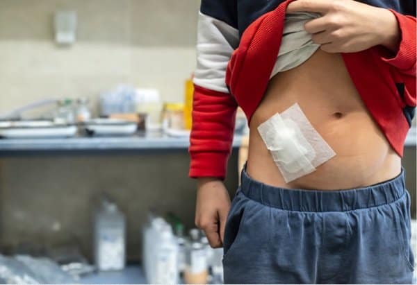 Depositphotos_319831260_s-2019.-deyangeorgiev2jpg Appendectomy, appendicitis