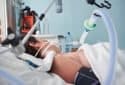 Protecting lungs from ventilator-induced injury
