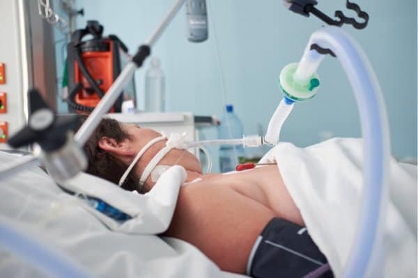Intubated ICU patient, mechanical ventilation