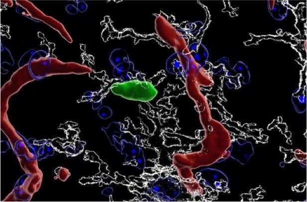 T cell in mouse brain - James Dooley, Babraham Institute T cell in mouse brain - James Dooley, Babraham Institute