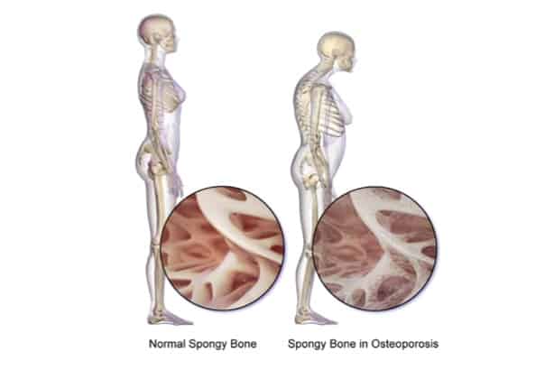 Oxytocin can help prevent osteoporosis