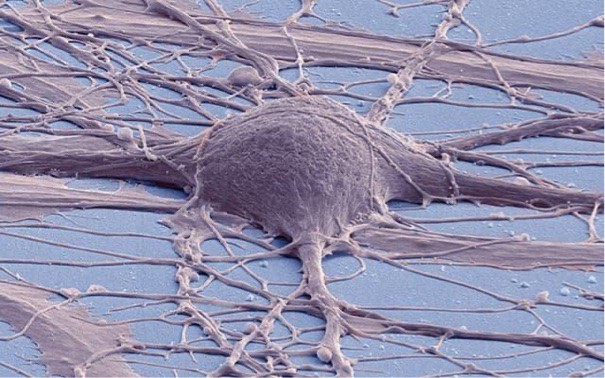 Cultured human neuron - Thomas Deerinck - UCSD Cultured human neuron - Thomas Deerinck - UCSD
