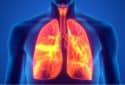 COVID-19 causes unexpected cellular response in the lungs
