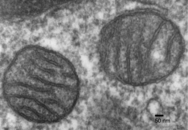 Sporadic Parkinson’s disease caused by mitochondria malfunction