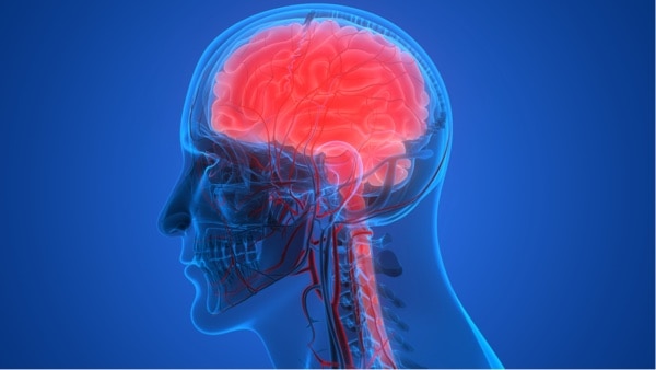 Study reveals immune driver of brain aging