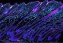 Fine-tuning stem cell metabolism prevents hair loss