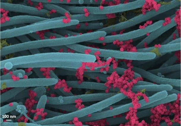 SARS-CoV-2 - Ehre Lab - UNC School of Medicine SARS-CoV-2 virions