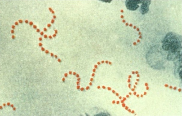 640px-Streptococcus_pyogenes 640px-Streptococcus_pyogenes
