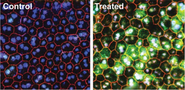 Base editing restores vision - Nature Biomedical Engineering Base editing restores vision - Nature Biomedical Engineering