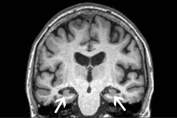 249257_web - Radiological Society of North America 249257_web - Radiological Society of North America