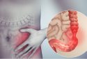 Specific gut bacterium linked to irritable bowel syndrome