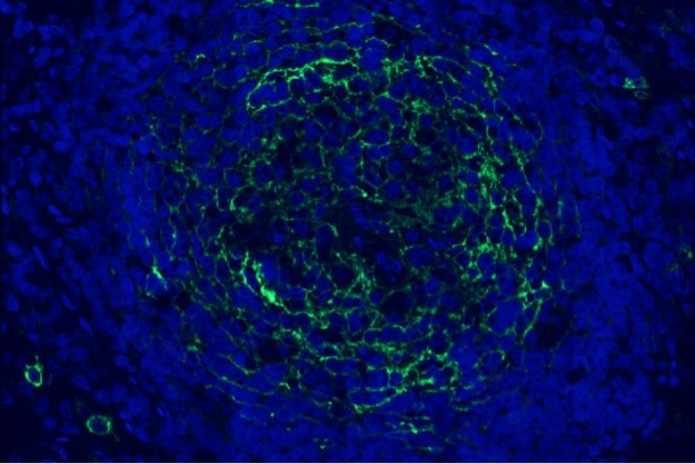 18_enpp1_488_cgas_591_dapi_63_02_c1-2-1200x800 18_enpp1_488_cgas_591_dapi_63_02_c1-2-1200x800