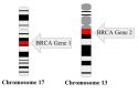 BRCA genes