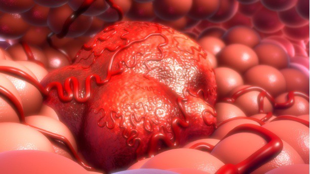 New computational tool reliably differentiates between cancer and normal cells from single-cell RNA-sequencing data