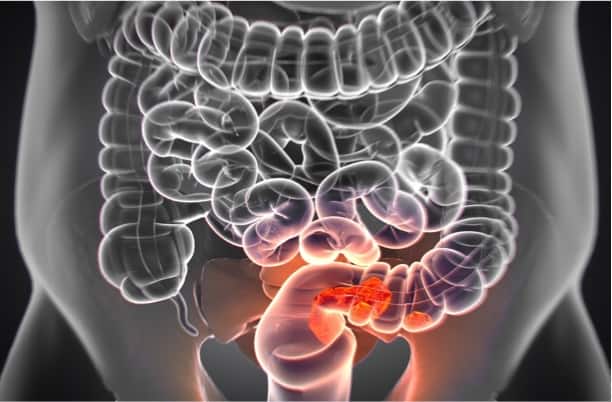 Novel potential therapeutic targets to inhibit colorectal cancer progression
