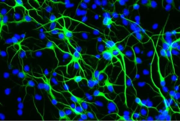 256944_web - Image courtesy of the Paik lab 256944_web - Image courtesy of the Paik lab
