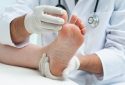 Simple foot test detects heart rhythm disorder diabetes patients