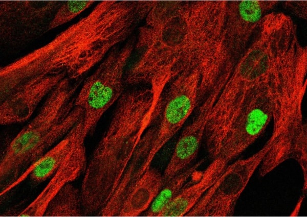 Muscle stem cells - Spuler Lab - ECRC