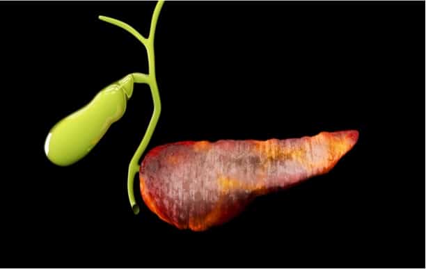 Depositphotos_213455302_s-2019crop-tussiksmailgmail.com acute pancreatitis, pancreatic inflammation