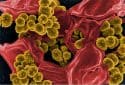 Staphylococcus aureus – NIAID