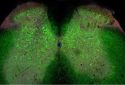 ALS development could be triggered by loss of network connections in the spinal cord