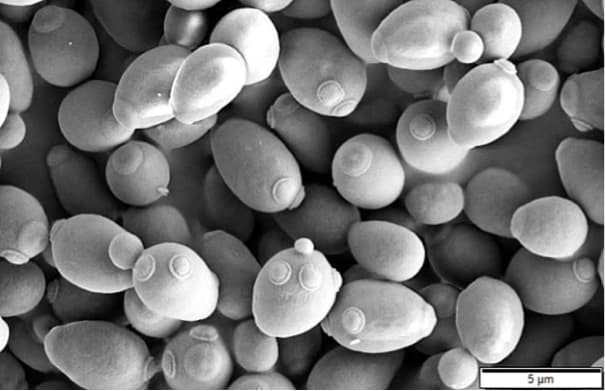 640px-Saccharomyces_cerevisiae_SEM 640px-Saccharomyces_cerevisiae_SEM