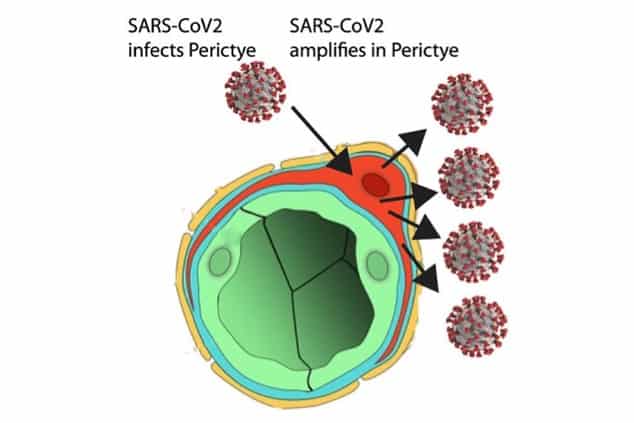 3D ‘assembloid’ model shows how SARS-CoV-2 infects brain cells