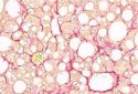 Fibrotic liver section – Helmholtz Zentrum München – Anne Loft