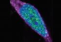 Low-Res_CHMP7 nucleus – Rothstein lab