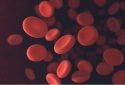 Red blood cell alterations contribute to lupus