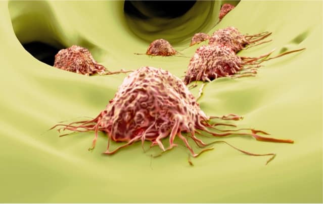 How the immune system responds to tissue damage can aid cancer spread