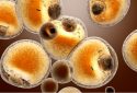 Deleting dysfunctional cells in fat tissue alleviates diabetes