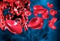 Novel gene therapy for hemophilia a leads to sustained expression of clotting factor and reduced bleeding events