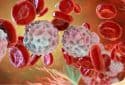 Study confirms nutrient’s role in childhood leukemia