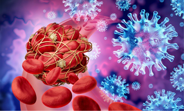 coronavirus, blood clot