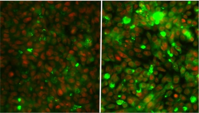 Colorectal cancers raise defensive barrier in response to chemotherapy