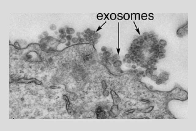 Electron micrograph showing cell exosomes.