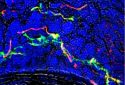 Atherosclerosis: How diseased blood vessels communicate with the brain