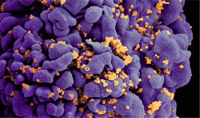 Combination anti-HIV antibody infusions suppress virus for prolonged period
