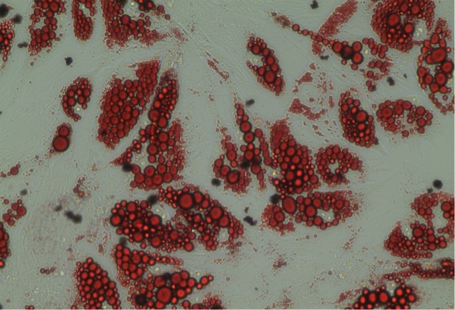 Human brown adipocytes, lipid stained red (RedO oil stain).