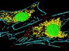 Cancer-associated fibroblasts can sensitize cancer cells to therapy