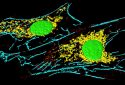 Cancer-associated fibroblasts can sensitize cancer cells to therapy