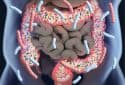 gut bacteria