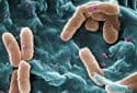 Antibiotic-resistant bacteria can travel from gut to lung, increasing infection risks