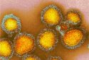 Colorized image of H3N2 influenza virus particles.