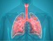 Carbon ultrafine particles accelerate lung cancer progression