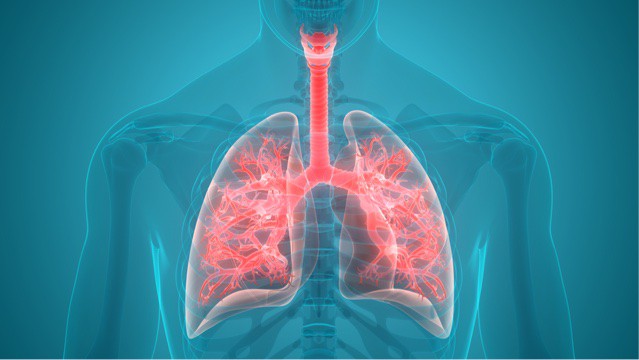 Carbon ultrafine particles accelerate lung cancer progression