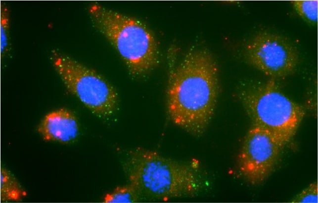 FuOXP-siRNA nanoparticles and mouse colon cancer cells.